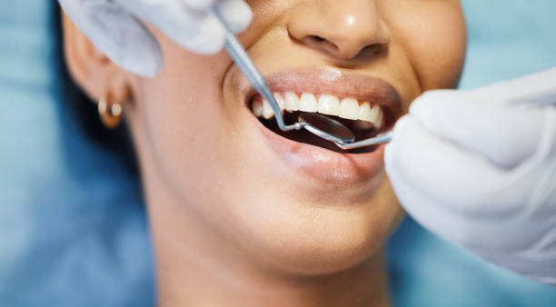 Best Emergency Wisdom Teeth Removal in Bellflower, CA